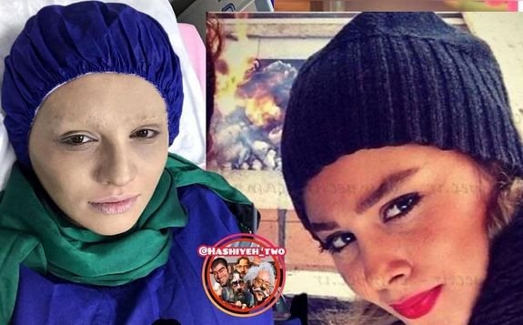 سرطان سارا همتی