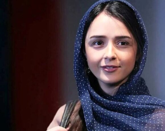 تغییر چهره ترانه علیدوستی بعد از تغییر دندانش