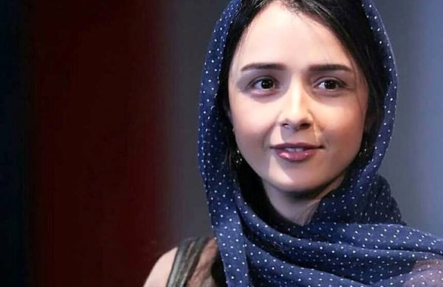 تغییر چهره ترانه علیدوستی بعد از تغییر دندانش