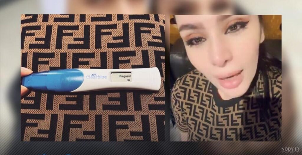 بارداری دنیا جهانبخت