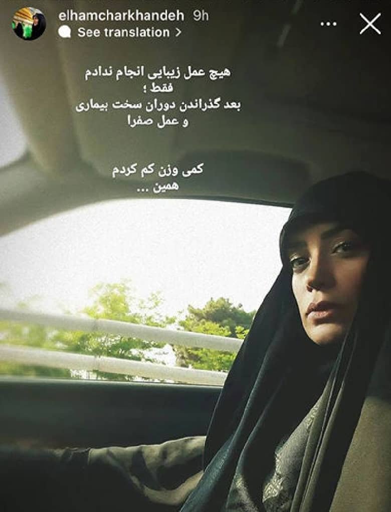 عمل زیبایی الهام چرخنده